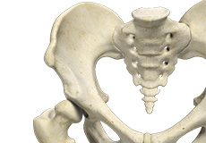 Hip Dysplasia (Acetabular Dysplasia)