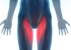 Groin Injuries in Athletes